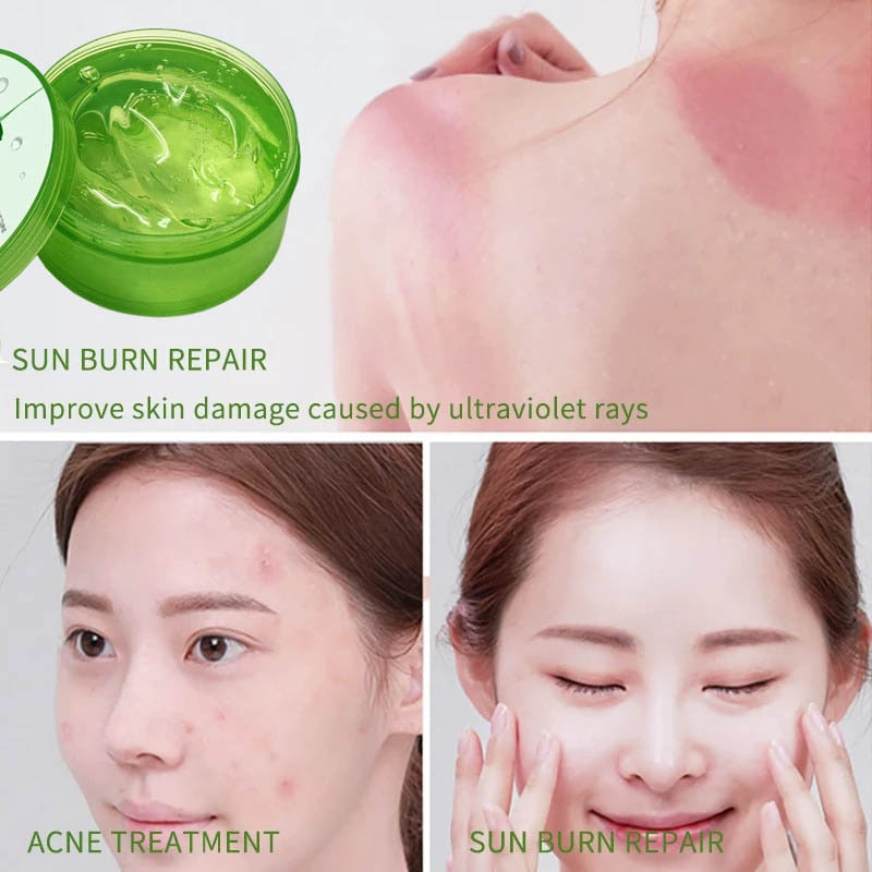 300g Aloe Vera Gel Pure Natural 98% Face Cream Moisturizer Soothing Gel Acne Treatment Scar Remove Sunburn Repair Aloe Cream