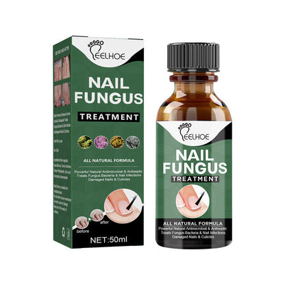 Nail Fungal Treatment Feet Care Essence Anti Infection Paronychia Onychomycosis Foot Toe Fungus Removal Gel Chinese Medicine 50ml